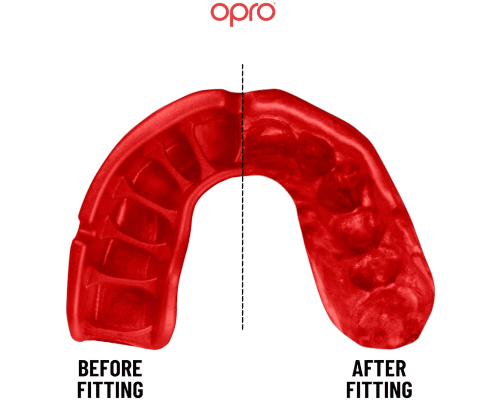 Best Boxing Mouthguards